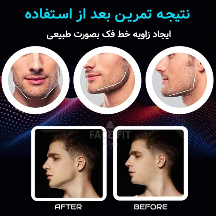 زاویه ساز صورت و فک بسته 6 عددی